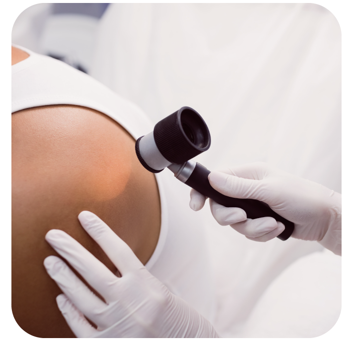 Clínica de la piel tratamiento del cáncer de piel