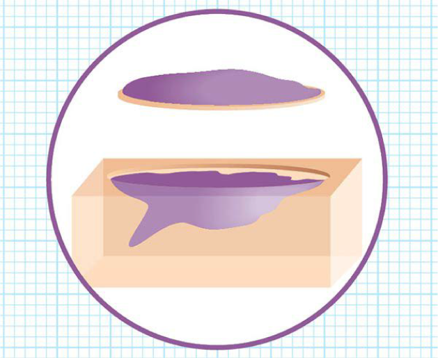 dermatólogo Oncólogo en cundinamarca